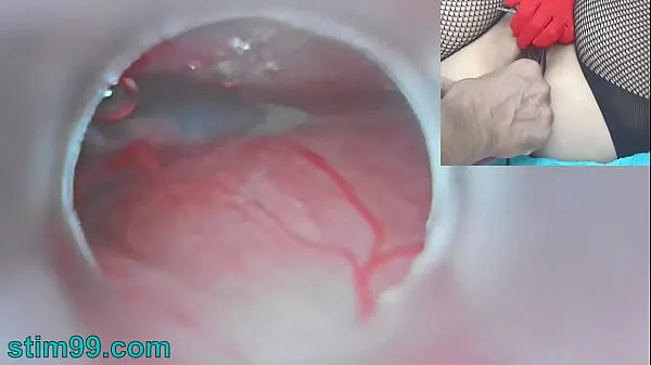XXX Asian Jav Pregnancy with Semen Injection in Cervix for Impregnation and Endoscopic Cam in Uterus to see inner new Videos